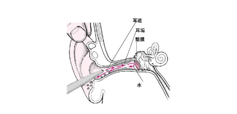 鼓膜